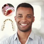 Simple Food Tips For Braces Wearers