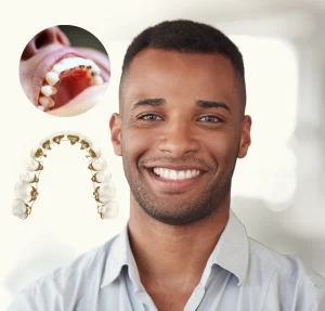 Simple Food Tips For Braces Wearers