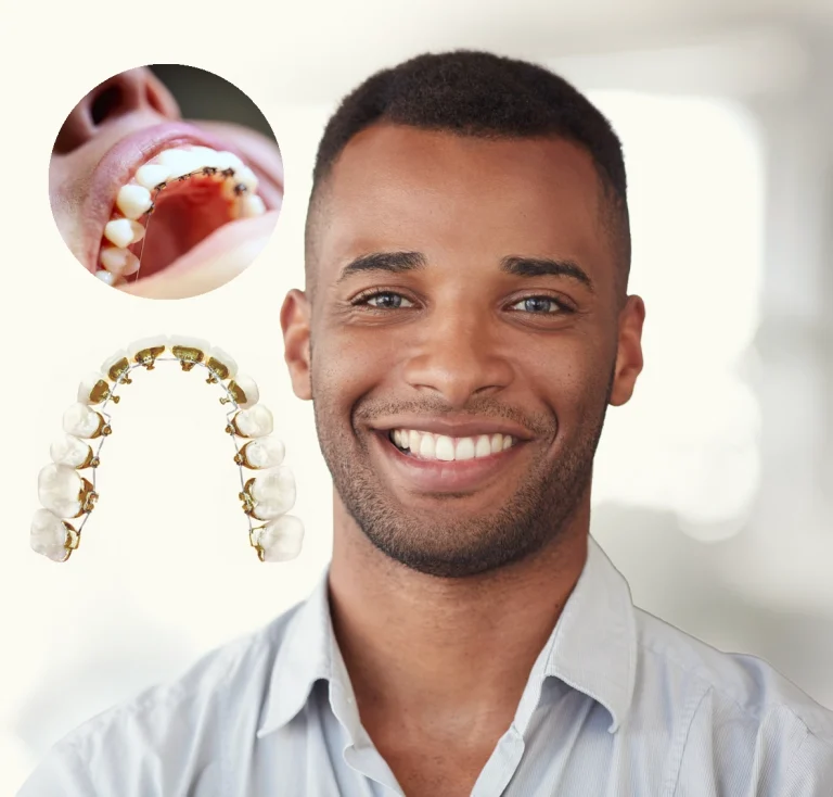 Simple Food Tips For Braces Wearers